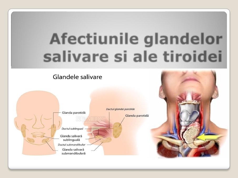 adenom al glandei salivare)